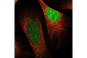 Immunofluorescent staining of human cell line U-2 OS shows localization to nucleus. (CBX5 anticorps  (AA 30-137))