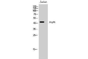 Western Blotting (WB) image for anti-Autophagy related 4B Cysteine Peptidase (ATG4B) (Internal Region) antibody (ABIN3183424) (ATG4B anticorps  (Internal Region))
