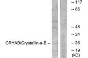 Western blot analysis of extracts from K562 cells, treated with Ca2+ 40nM 30', using CRYAB (Ab-59) Antibody. (CRYAB anticorps  (AA 31-80))