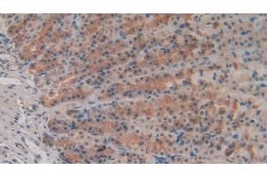 Detection of MMP3 in Rat Stomach Tissue using Polyclonal Antibody to Matrix Metalloproteinase 3 (MMP3) (MMP3 anticorps  (AA 278-450))