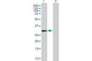 Western Blot analysis of SLC22A24 expression in transfected 293T cell line by SLC22A24 MaxPab polyclonal antibody. (SLC22A24 anticorps  (AA 1-322))