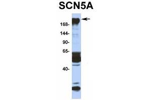 Host:  Rabbit  Target Name:  SCN5A  Sample Type:  Human Fetal Muscle  Antibody Dilution:  1. (SCN5A anticorps  (N-Term))