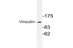 Image no. 1 for anti-Vinculin (VCL) antibody (ABIN272104) (Vinculin anticorps)