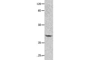 Western blot analysis of Human leiomyosarcoma tissue, using GNA11 Polyclonal Antibody at dilution of 1:450