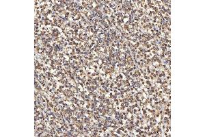 IHC analysis of TST using anti-TST antibody (ABIN7599105). (TST anticorps  (AA 1-220))