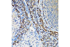 Immunohistochemistry of paraffin-embedded rat ovary using SRP19 antibody (ABIN2560139) at dilution of 1:100 (40x lens). (SRP19 anticorps)