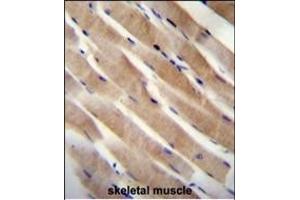 RHEB Antibody (C-term) (ABIN655712 and ABIN2845163) immunohistochemistry analysis in formalin fixed and paraffin embedded human skeletal muscle followed by peroxidase conjugation of the secondary antibody and DAB staining. (RHEB anticorps  (C-Term))
