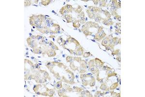 Immunohistochemistry of paraffin-embedded human gastric using SPICE1 antibody at dilution of 1:100 (x40 lens). (SPICE1 anticorps)