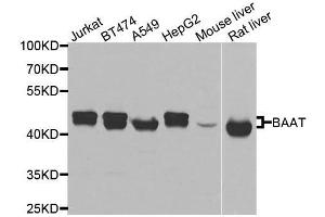 Western blot analysis of extracts of various cell lines, using BAAT antibody. (BAAT anticorps  (AA 309-418))