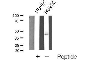 Western blot analysis of Cathepsin E expression in HUVEC cells (Cathepsin E anticorps  (Internal Region))