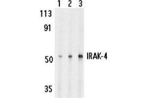 Western blot analysis of IRAK-4 in HeLa cell lysate with AP30442PU-N IRAK-4 antibody at 1 (lane 1), 2 (lane 2), and 4 (lane 3) μg/ml, respectively. (IRAK4 anticorps)