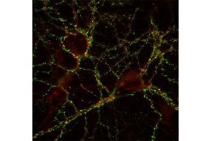 Indirect immunostaining of hippocampus neurons with anti-GABA-A receptor β3 (dilution 1 : 500; red) and anti-synapsin (, dilution 1 : 500; green).