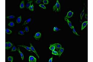 anti-Snail Family Zinc Finger 2 (SNAI2) (AA 12-124) antibody