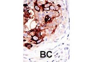 anti-SUMO1/sentrin/SMT3 Specific Peptidase 2 (SENP2) (AA 502-533), (C-Term) antibody