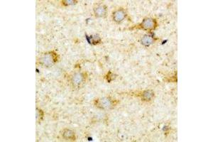 Immunohistochemical analysis of ACOX1 staining in mouse brain formalin fixed paraffin embedded tissue section. (ACOX1 anticorps)