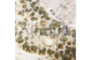 ABIN6267588 at 1/100 staining human lung tissues sections by IHC-P.