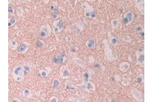 IHC-P analysis of Human Cerebrum Tissue, with DAB staining. (CYP1A2 anticorps  (AA 2-231))