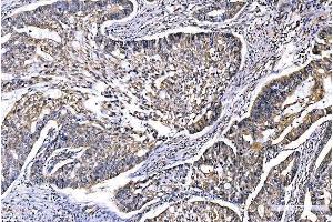 IHC analysis of GFPT1 using anti-GFPT1 antibody (ABIN7602887). (GFPT1 anticorps  (C-Term))