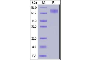 Rabbit M-CSF R, His Tag on  under reducing (R) condition.