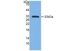 Detection of Recombinant SFN, Mouse using Polyclonal Antibody to Stratifin (SFN) (14-3-3 sigma/SFN anticorps  (AA 1-249))