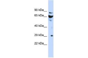 WB Suggested Anti-DCUN1D3 Antibody Titration: 0. (DCUN1D3 anticorps  (N-Term))