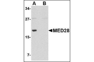 Western blot analysis of MED28 in human brain tissue lysate with this product at 1 μg/ml in (A) the absence and (B) the presence of blocking peptide. (MED28 anticorps  (Center))