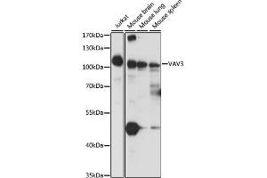 Western blot analysis of extracts of various cell lines, using V antibody  at 1:1000 dilution. (VAV3 anticorps  (AA 560-680))