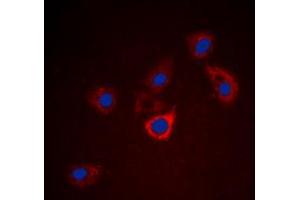 Immunofluorescent analysis of BCL2 staining in HeLa cells. (Bcl-2 anticorps  (Center))