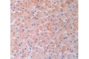 IHC-P analysis of liver tissue, with DAB staining.