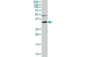 ANKRA2 monoclonal antibody (M01), clone 1D11 Western Blot analysis of ANKRA2 expression in IMR-32 .