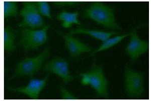 ICC/IF analysis of PGAM1 in HeLa cells line, stained with DAPI (Blue) for nucleus staining and monoclonal anti-human PGAM1 antibody (1:100) with goat anti-mouse IgG-Alexa fluor 488 conjugate (Green). (PGAM1 anticorps)