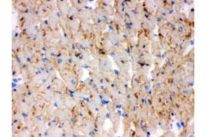 IHC testing of frozen mouse heart tissue with CPT1B antibody. (CPT1B anticorps)