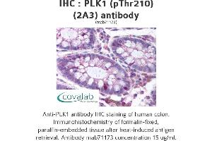 Image no. 1 for anti-Polo-Like Kinase 1 (PLK1) (pThr210) antibody (ABIN1724011) (PLK1 anticorps  (pThr210))