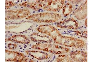 Immunohistochemistry of paraffin-embedded human kidney tissue using ABIN7159169 at dilution of 1:100 (Medium-Chain Specific Acyl-CoA Dehydrogenase, Mitochondrial (AA 26-421) anticorps)