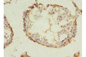 Immunohistochemistry of paraffin-embedded human testis tissue using ABIN7143242 at dilution of 1:100 (ACOT9 anticorps  (AA 1-212))
