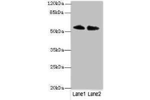 Western blot All lanes: TRIM55 antibody at 1 μg/mL Lane 1: Hela whole cell lysate Lane 2: Mouse liver tissue Secondary Goat polyclonal to rabbit IgG at 1/10000 dilution Predicted band size: 61, 51, 27 kDa Observed band size: 61 kDa (TRIM55 anticorps  (AA 101-300))
