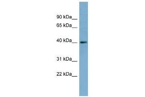 RP2 antibody used at 1 ug/ml to detect target protein. (RP2 anticorps)