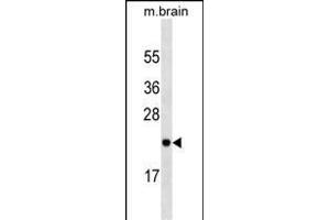 RAB23 Antibody (ABIN1539872 and ABIN2843843) western blot analysis in mouse brain tissue lysates (35 μg/lane). (RAB23 anticorps)