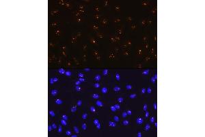 Immunofluorescence analysis of C6 cells using Fibrillarin/U3 RNP Rabbit mAb (ABIN7267175) at dilution of 1:100 (40x lens).