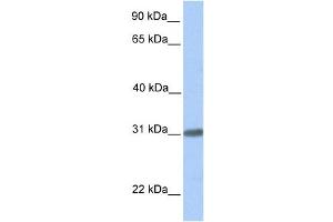 Western Blotting (WB) image for anti-Chromosome 7 Open Reading Frame 61 (C7orf61) antibody (ABIN2459744) (C7orf61 anticorps)