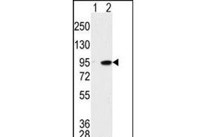Western blot analysis of K (arrow) using K Antibody (C-term) (ABIN391782 and ABIN2841639). (MAK anticorps  (C-Term))