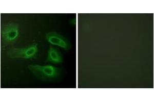 Immunofluorescence analysis of HeLa cells, using Caspase 9 (Ab-196) Antibody. (Caspase 9 anticorps  (AA 162-211))