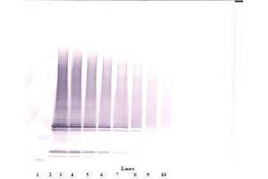 Image no. 1 for anti-Interleukin 17F (IL17F) antibody (ABIN465701) (IL17F anticorps)