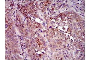 Immunohistochemistry (IHC) image for anti-CD33 (CD33) (AA 15-237) antibody (ABIN1845398) (CD33 anticorps  (AA 15-237))