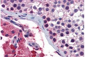 Human Testis: Formalin-Fixed, Paraffin-Embedded (FFPE)