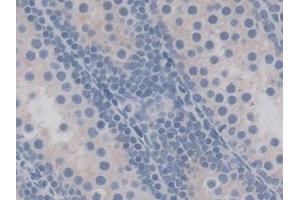 Detection of EIF2aK3 in Mouse Testis Tissue using Polyclonal Antibody to Eukaryotic Translation Initiation Factor 2 Alpha Kinase 3 (EIF2aK3)