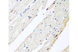 Immunohistochemistry of paraffin-embedded Rat heart using VCP Polyclonal Antibody at dilution of 1:200 (40x lens).