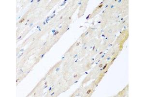 Immunohistochemistry of paraffin-embedded Rat heart using VCP Polyclonal Antibody at dilution of 1:200 (40x lens). (VCP anticorps)