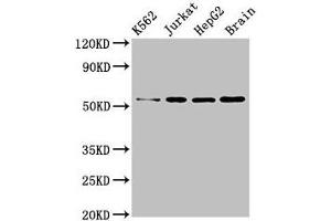 Western Blot Positive WB detected in: K562 whole cell lysate, Jurkat whole cell lysate, HepG2 whole cell lysate, Mouse brain tissue All lanes: SLC16A8 antibody at 3 μg/mL Secondary Goat polyclonal to rabbit IgG at 1/50000 dilution Predicted band size: 53 kDa Observed band size: 53 kDa (MCT3 anticorps  (AA 432-504))