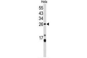 Western blot analysis of CENPH Antibody (Center) in Hela cell line lysates (35µg/lane). (CENPH anticorps  (Middle Region))